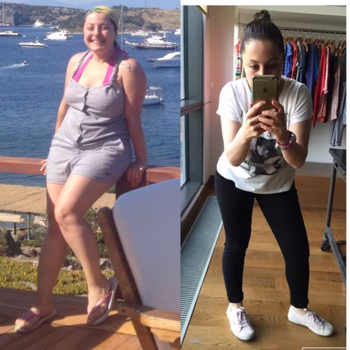 Sema Ozpekmezci Oncesi Sonrasi